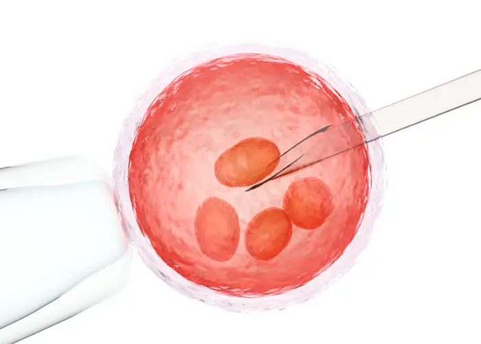 Intrauterine insemination (IUI)