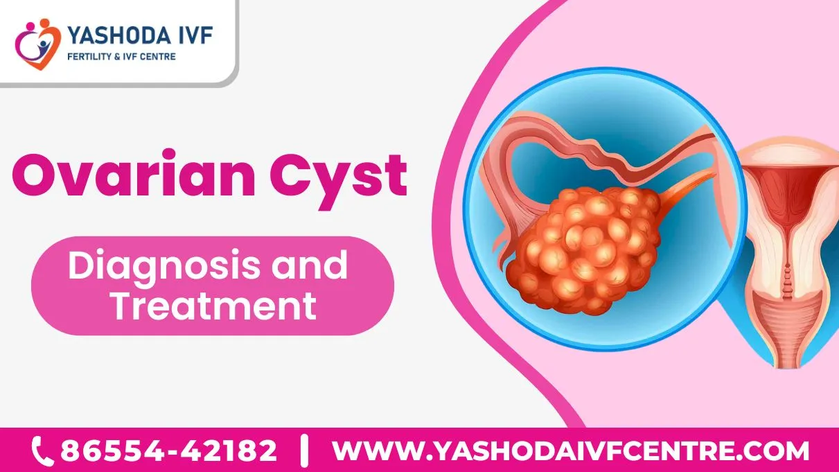 ovarian cyst diagnosis and treatment
