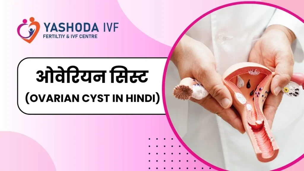 ovarian-cyst-in-hindi